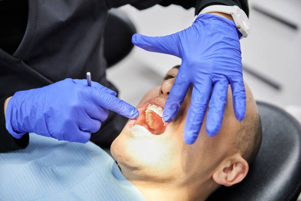 Best Emergency Root Canal Treatment in Red Bay, AL